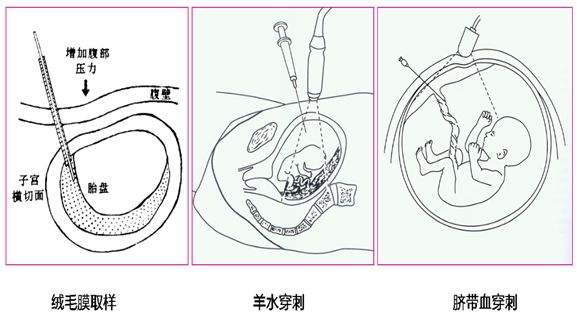 亲子鉴定中心